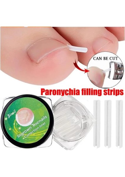 30 Adet ve 2 Araç 10 Adet Batık Ayak Tırnağı Düzeltme Aracı Batık Ayak Tırnak Tedavisi Elastik Yama Etiket Doğrultma Klip Brace Pedikür Aracı (Yurt Dışından) fiyatları