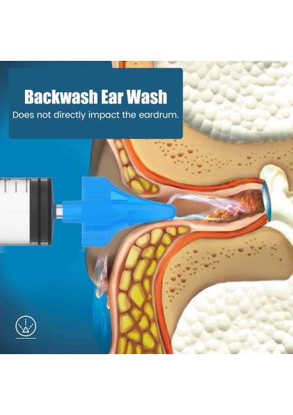 2 Adet 2 Adet Kulak Yıkama Şırıngası Kulak Temizleyici Seti Kulak Balmumu Temizleyici Kulak Kirini Çıkarıcı Temizleyici Su Temizleme Araçları Bebek Çocuk Yetişkin Dropshipping (Yurt Dışından) indirimleri