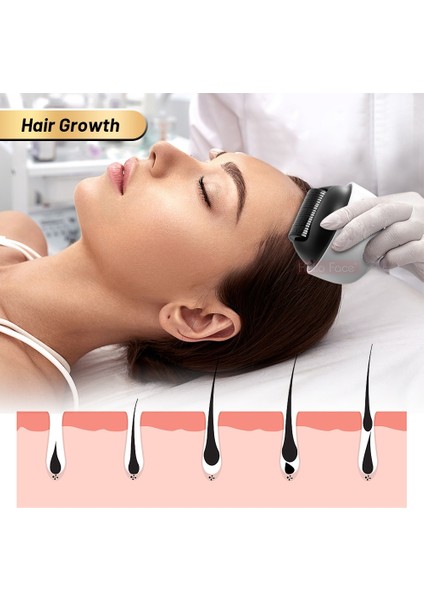 1200 Pin-1 Hello Face Dermaroller 1200 Pin Microneedle Bio Roller G4 Saç Büyüme Vücut Çatlaklarını Giderme Ayrı Kapaklı Cilt Bakımı (Yurt Dışından) fırsatları