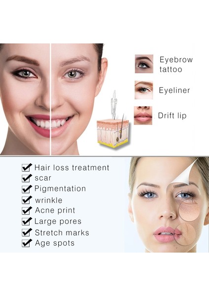 50 Adet Derma Araçları Mym Iğneler Kartuş Iğne 9 Pin/12 Pin/36 Pin/3d/5d Süngü Vida Bağlantı Noktası Elektrikli Mikro Haddeleme Mts Terapi (Yurt Dışından)