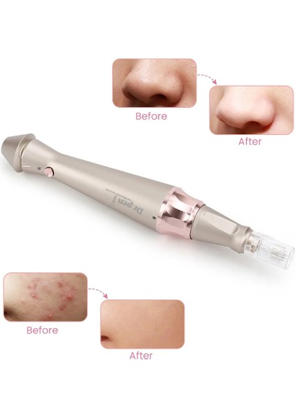 10 Adet R3 Dr. Kalem E30 Kablolu Mikro Iğne Derma Kalem Otomatik Dermapen Cilt Bakım Makinesi 8 Pcs Süngü Iğneler ile 5 Seviye Ayarı (Yurt Dışından)