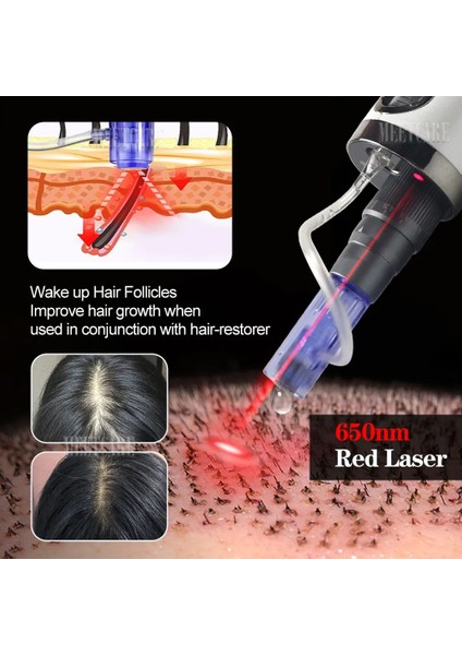 10 Adet 9 Pin İğne Hydra Enjektör Derma Mikroiğne Kalem Mezoterapi (Yurt Dışından)