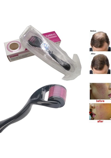 Bize Boyutunu Söyleyin Derma Roller Drs 540 Mikro Iğne Mikroiğne Cilt Bakımı Tedavisi Saç Derisi Saç Sakal Uzatma Mesorollor Agulha Mento Mezoroller (Yurt Dışından)