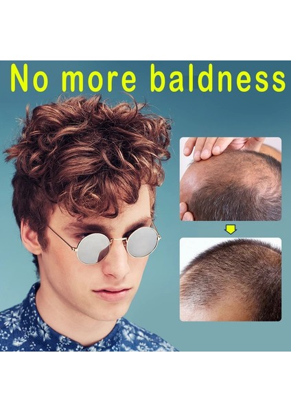 Erkekler Için 1'li Hızlı Saç Büyüme Paketi Polygonum Bitkisel Özler Saç Dökülmesine Karşı Serum Kurtarma Saç Çizgisi Kellik Folikül Tedavisi Saç Bakımı (Yurt Dışından) modelleri