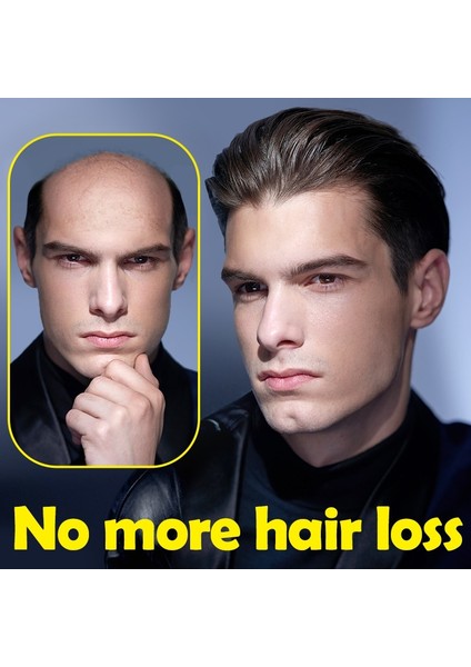 Erkekler Için 1'li Hızlı Saç Büyüme Paketi Polygonum Bitkisel Özler Saç Dökülmesine Karşı Serum Kurtarma Saç Çizgisi Kellik Folikül Tedavisi Saç Bakımı (Yurt Dışından) fırsatları