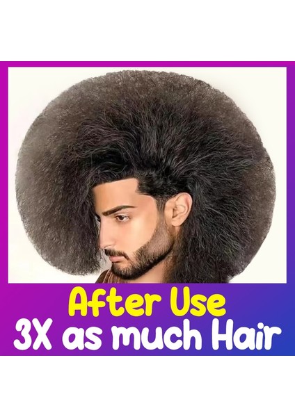 Erkekler Için 1'li Hızlı Saç Büyüme Paketi Polygonum Bitkisel Özler Saç Dökülmesine Karşı Serum Kurtarma Saç Çizgisi Kellik Folikül Tedavisi Saç Bakımı (Yurt Dışından) indirimleri