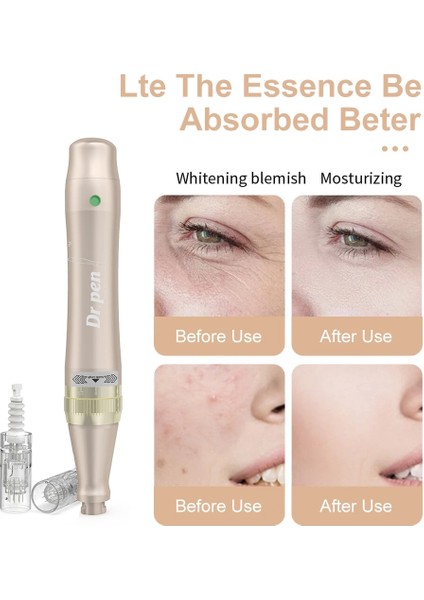 10 Adet 12 Pin Dr.pen Ultima M5 Elektrikli Profesyonel Derma Kalem Cilt Bakım Cihazı Mikro Iğneleme Makinesi Mezoterapi Gençleştirme Sistemi Terapisi (Yurt Dışından) indirimleri