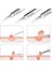 C No Box Siyah Nokta Akne Sivilce Sökücü Aracı Yüz Cilt Bakım Ürünleri Seti Pinzas Para Espinillas Siyah Kafa Kaldırma Cımbız Yüz Temizleyici (Yurt Dışından) 5