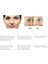 Siyah 0.25 mm 540 Iğneler Mikro Iğne Derma Rulo Tıbbi Terapi Cilt 0.2MM/0.25MM/0.3MM Iğne Uzunluğu Vücut Güzellik Bakım Aracı Altın Gümüş (Yurt Dışından) 4