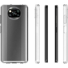 Case 4U Xiaomi Poco X3 / Poco X3 Pro Kılıf A+ Şeffaf Lüx Süper Yumuşak 0.3mm Ince Slim Silikon