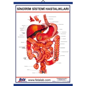 Sindirim Sistemi Hastalıkları Eğitim Plakası
