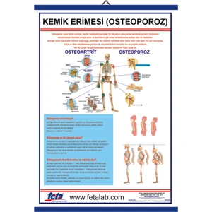 Osteoporoz Eğitim Plakası Kemik Erimesi