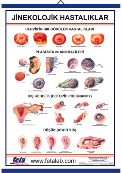 Jinekolojik Hastalıklar Eğitim Plakası