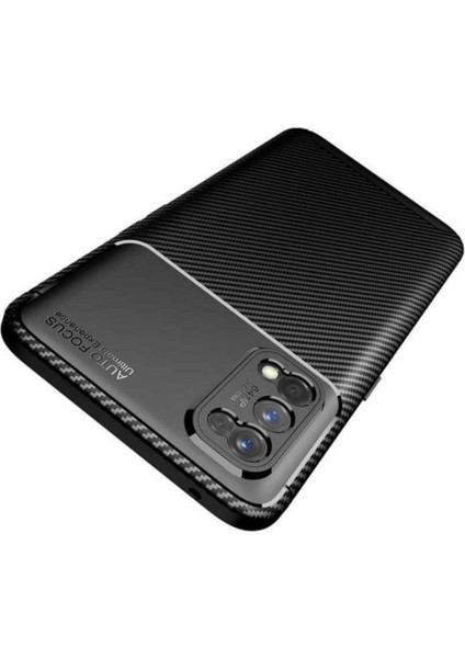 Case 4U Oppo Realme 7 Pro Kılıf Rugged Armor Karbon Desenli Lüx Negro Silikon Arka Kapak Siyah