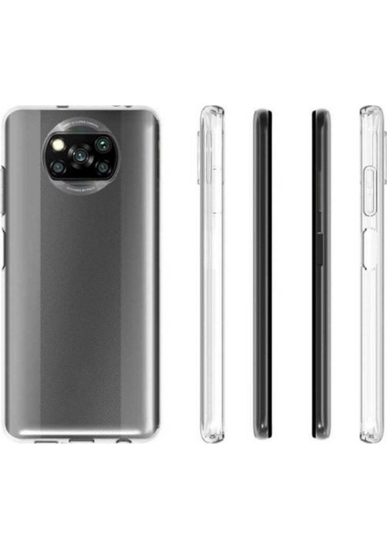 Case 4U Xiaomi Poco X3 / Poco X3 Pro Kılıf A+ Şeffaf Lüx Süper Yumuşak 0.3mm Ince Slim Silikon