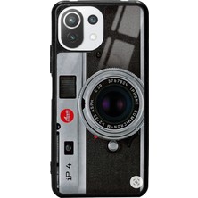 S-Case Xiaomi Mi 11 Lite Lens Tasarımlı Glossy Telefon Kılıfı