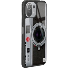 S-Case Xiaomi Mi 11 Lite Lens Tasarımlı Glossy Telefon Kılıfı