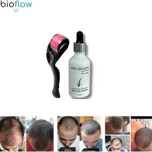 Hair Saçgürleştirici - Saç Çıkartıcı Saç Bakım Losyonu
