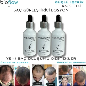 - Saç Bakım Losyonu 3 adet