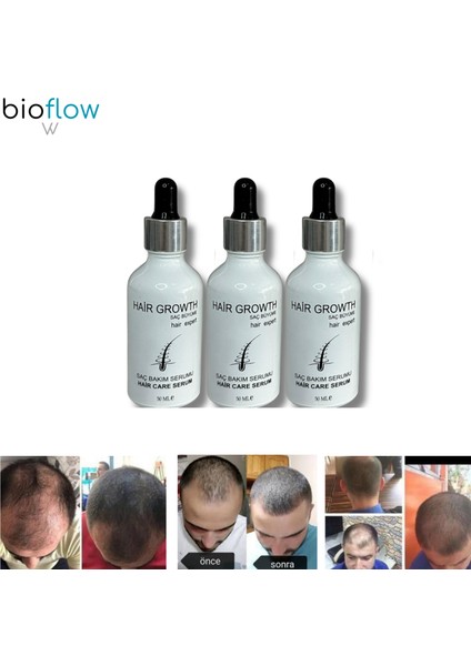 Hair Serum Saç Bakım Yağı / 3 Adet + Roller fiyatları