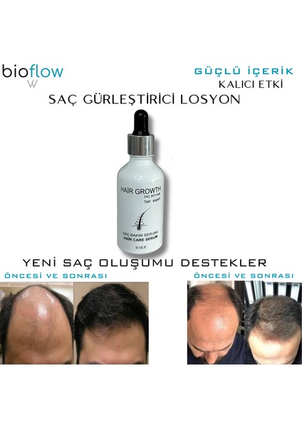 Hair Serum Saç Bakım Yağı / 3 Adet + Roller