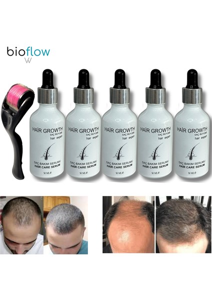 Serum Saç Bakım Yağı / 5 Adet +Roller