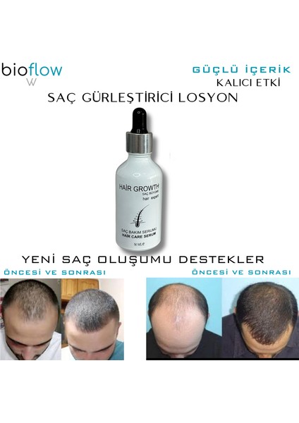 Serum Saç Bakım Yağı / 5 Adet +Roller modelleri