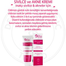 NLife ve Kremi Komple Tüm Ciltler 75 ml