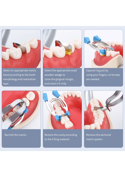 Azdent Dental Matris Kesit Konturlu Metal Yaylı Klips Halkaları Kelepçeler Takozlar Diş Hekimi Araçları (Yurt Dışından) indirimleri