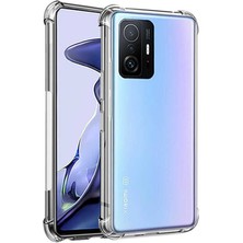 Dijimedia Xiaomi   Mi 11T Nitro Anti Shock Silikon Kılıf