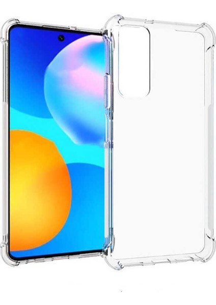 Xiaomi Redmi Note 10 Pro Köşeli Şeffaf Anti Shock Silikon Kılıf