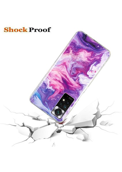 Xiaomi Redmi Için Note 11 4g (Qualcomm)/not 11S 4g Imd Mermer Desen Cep Telefon Kapağı Esnek Tpu Bırak-Kötü Kılıf Kırmızı (Yurt Dışından) modelleri