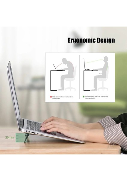 1 Çift Metal Metal Katlanabilir Dizüstü Bilgisayar Standı Kaymaz Taban Braketi Desteği Macbook Pro Air Için Lenovo Thinkpad Pc Dizüstü Bilgisayarlar Mini Soğutma Standı Ayakları (Yurt Dışından) fırsatları