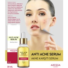 Adessa Anti Acne Serum - Akne Karşıtı Serum 30 ml