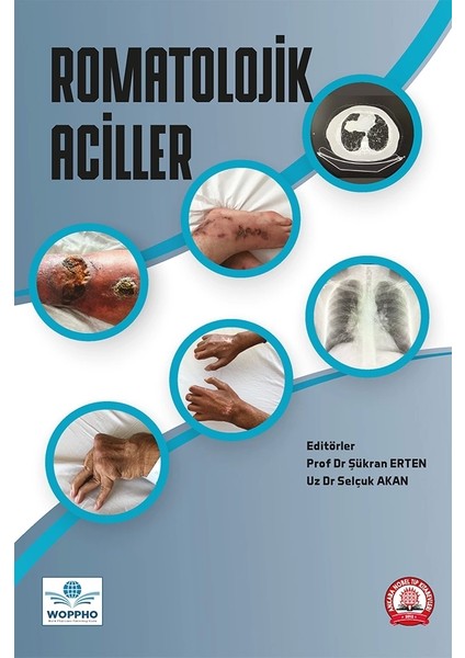 Romatolojik Aciller - Şükran Erten