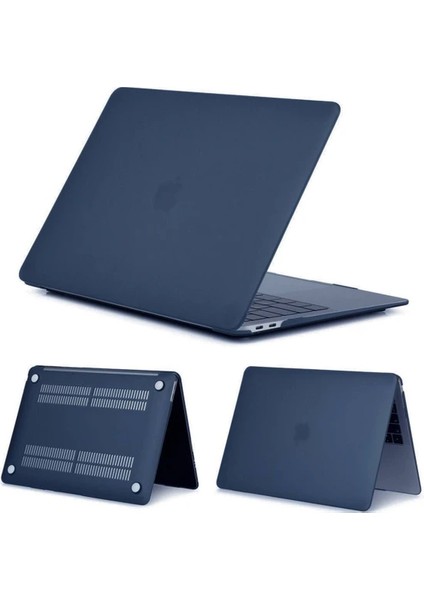 Macbook Pro 15 A1398 Retina Kılıf Rubber Koruma Kapak