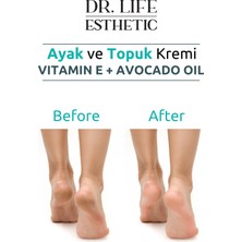 Dr. Life Ayak ve Topuk Kremi Crack Repair Cream 100 ml