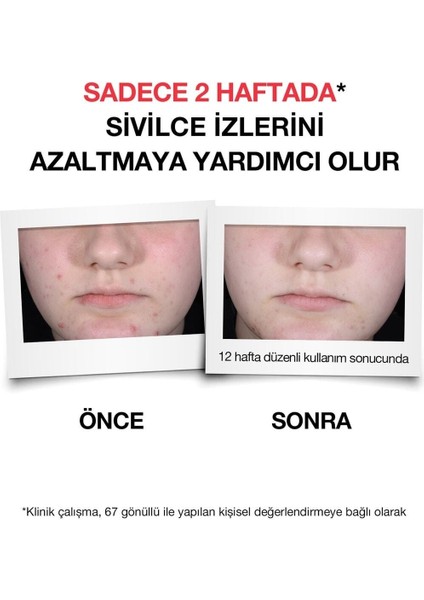 Sivilce Karşıtı + Serum 30 ml x 2 Adet (Yeni Ürün)