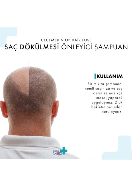 Stop Hair Loss Shampoo Kofre