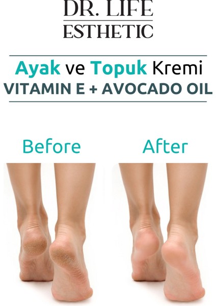 Ayak ve Topuk Kremi Crack Repair Cream 100 ml