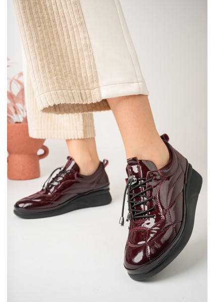 Kadın Hakiki Deri Bordo Rugan Anatomik Taban Rahat Lastik Bağcıklı Ayakkabı fiyatları