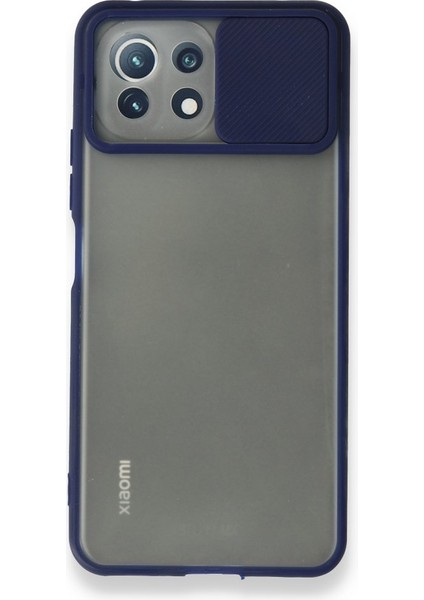 Xiaomi Mi 11 Lite Kılıf Palm Buzlu Kamera Sürgülü Silikon modelleri