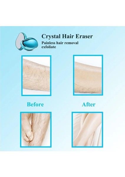 Crystal Eraser Epilasyon Aleti, Tüy Dökücü, Tüy Silgisi, Kristal Taş modelleri