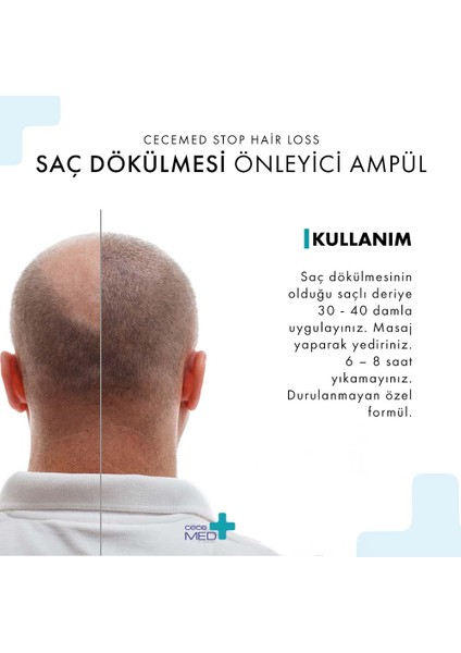 Stop Hair Loss Scalp Ampoules Saç Bakım Ampulü 5 x 7 ml