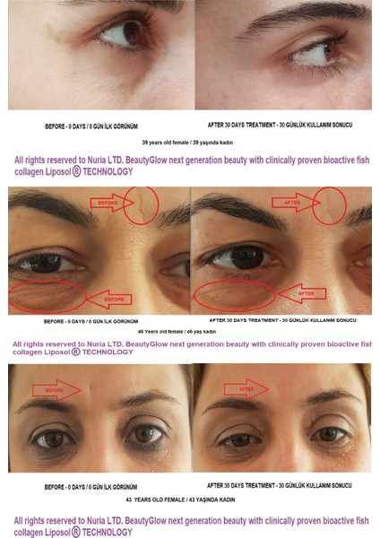 BEAUTY GLOW Aktif Liposol® Teknolojili Balık Kolajeni 25 ml x 30 Tüp