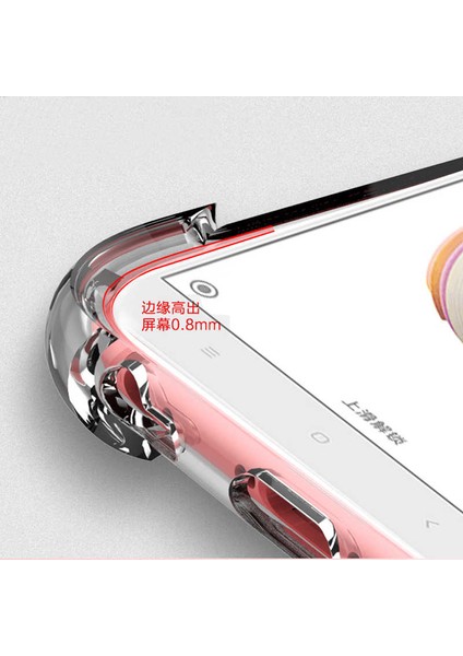 Xiaomi Mi 5x Kılıf Nitro Anti Shock Darbe Emici Silikon Kapak