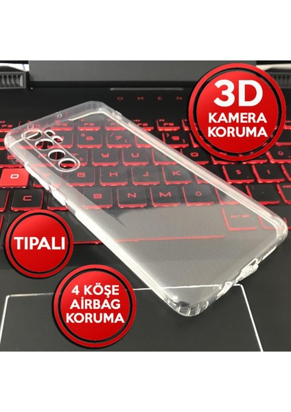 Xiaomi Redmi Note 9s Tıpalı Kamera Korumalı Şeffaf Silikon Kılıf