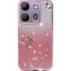 Seçili Renk Rose - Gold