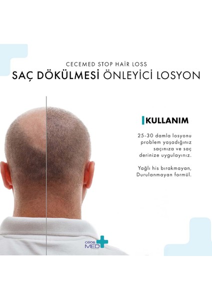Stop Hair Loss Lotion Saç Losyon 75 ml