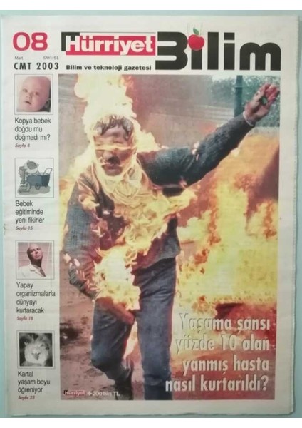 Hürriyet Gazetesi Bilim Eki 8 Mart 2003 Yaşama Şansı Yüzde 10 Olan Yanmış Hasta Nasıl Kurtarıldı -GZ33204